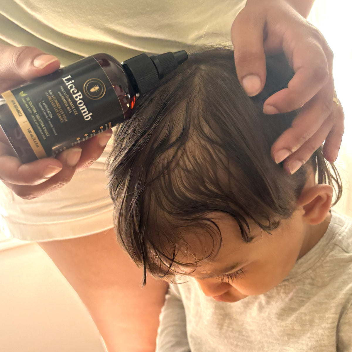 Applying LiceBomb head lice treatment to the hair and scalp